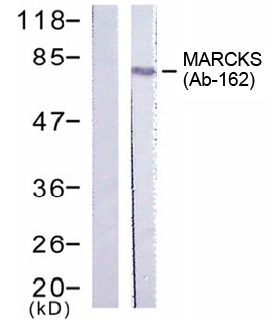 Anti MARCKS (Ab-162) Western blot analysis using anti MARCKS (Ab-162)