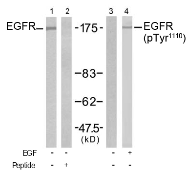 Rabbit Anti-EGFR (Ab-1110) Polyclonal Antibody WB Rabbit Anti-EGFR (Ab-1110) Polyclonal Antibody WB