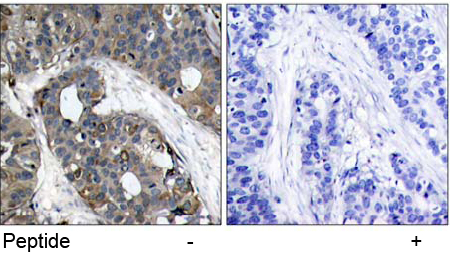Anti HSP27 (Ab-82) Immunohistochemical analysis using anti HSP27 (Ab-82)