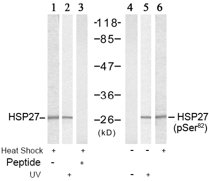 Anti HSP27 (Ab-82) Western blot analysis using anti HSP27 (Ab-82)