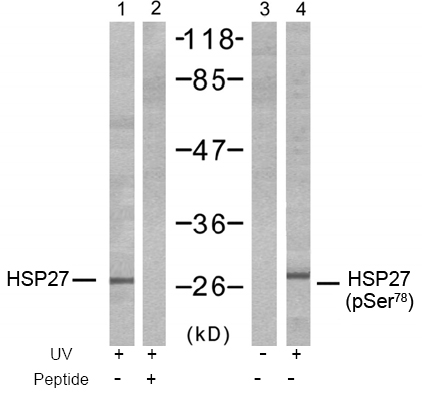 Anti HSP27 (Ab-78) Western blot analysis using anti HSP27 (Ab-78)