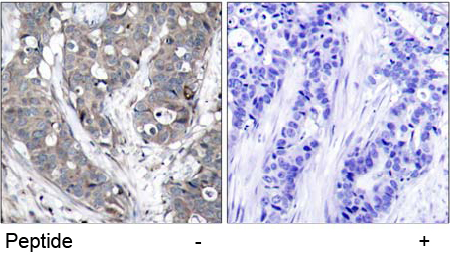 Anti HSP27 (Ab-78) Immunohistochemical analysis using anti HSP27 (Ab-78)