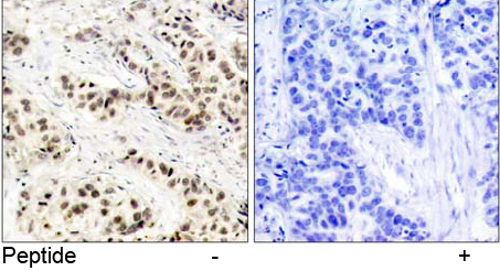 Rabbit Anti-CDC2 (Ab-15) Polyclonal Antibody IHC IRabbit Anti-CDC2 (Ab-15) Polyclonal Antibody IHC