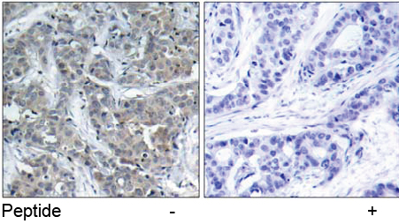 Rabbit Anti-Stathmin 1 (Ab-15) Polyclonal Antibody IHC Rabbit Anti-Stathmin 1 (Ab-15) Polyclonal Antibody IHC