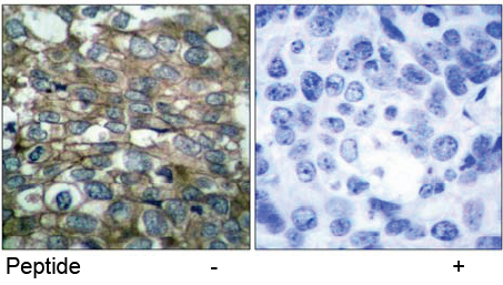 Anti EGFR (Ab-869) Immunohistochemical analysis using anti EGFR (Ab-869)