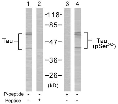Rabbit Anti-Tau (Ab-262) Polyclonal Antibody WB