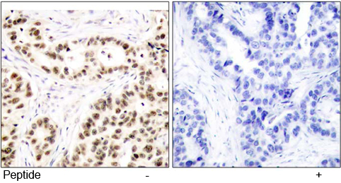 Anti Elk-1 (Ab-417) Immunohistochemical analysis using anti Elk-1 (Ab-417)