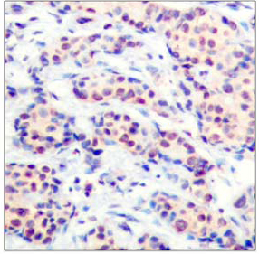Rabbit Anti-JunD (Ab-255) Polyclonal Antibody IHC Rabbit Anti-JunD (Ab-255) Polyclonal Antibody IHC