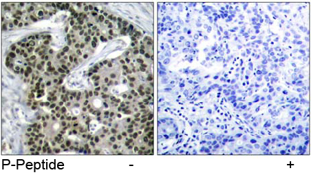 Anti HSF1 (Phospho-Ser 303) Immunohistochemical analysis using anti HSF1 (Phospho-Ser 303)