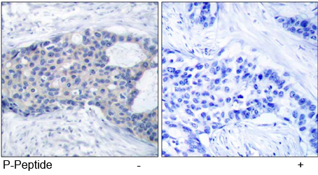 Rabbit Anti Zap-70 (Phospho-Tyr493) Immunohistochemical analysis using Rabbit Anti Zap-70 (Phospho-Tyr493)