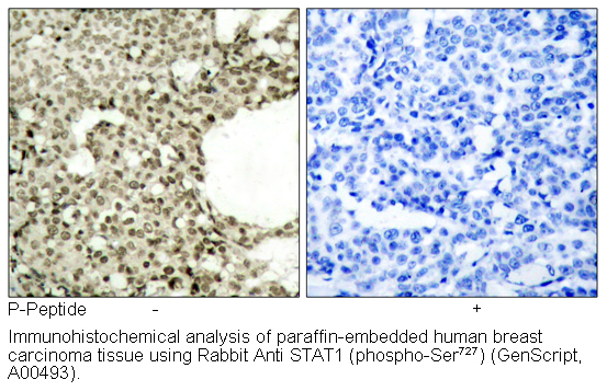 Immunohistochemical analysis using Rabbit Anti STAT1 (Phospho-Ser727)