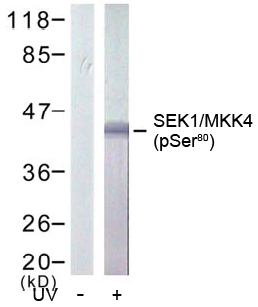 Western blot analysis using Rabbit Anti SEK1/MKK4 (Phospho-Ser80)