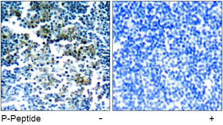 Immunohistochemical analysis using Rabbit Anti Bcr (Phospho-Tyr177)
