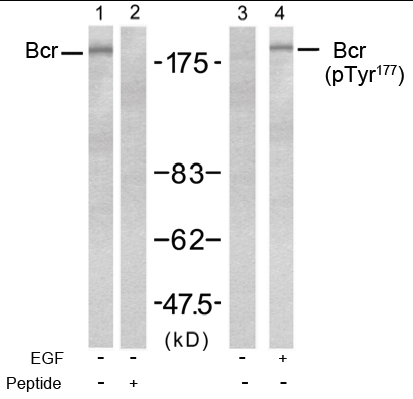 Western blot analysis using Rabbit Anti Bcr (Phospho-Tyr177)