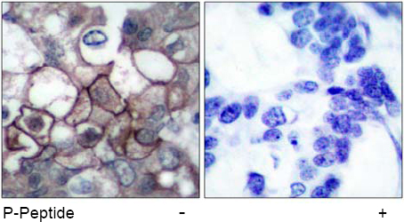 Rabbit Anti EGFR (Phospho-Tyr1197) Immunohistochemical analysis using Rabbit Anti EGFR (Phospho-Tyr1197)