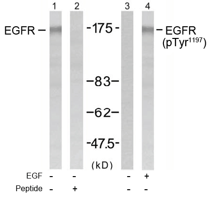 Rabbit Anti EGFR (Phospho-Tyr1197) Western blot analysis using Rabbit Anti EGFR (Phospho-Tyr1197)