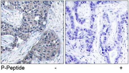 Immunohistochemical analysis using Rabbit Anti eIF4E (Phospho-Ser209)