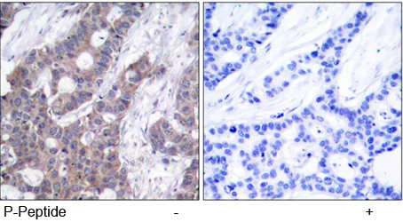 Rabbit Anti Stathmin 1 (Phospho-Ser15) Immunohistochemical analysis using Rabbit Anti Stathmin 1 (Phospho-Ser15)