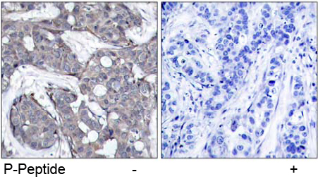 Rabbit Anti HSP27 (Phospho-Ser82) Immunohistochemical analysis using Rabbit Anti HSP27 (Phospho-Ser82)