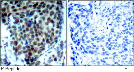 Immunohistochemical analysis using Rabbit Anti p38 MAPK (Phospho-Thr180)