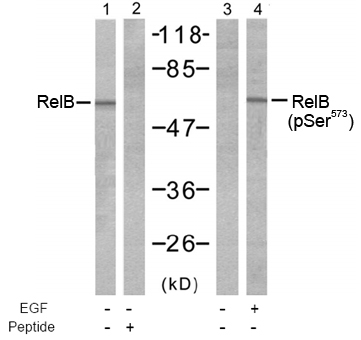 Rabbit Anti RelB (Phospho-Ser552) Western blot analysis using Rabbit Anti RelB (Phospho-Ser552)