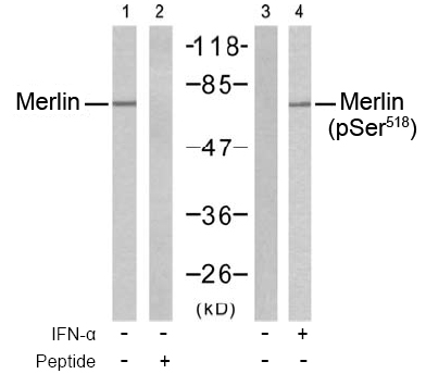 Rabbit Anti Merlin (Phospho-Ser518) Western blot analysis using Rabbit Anti Merlin (Phospho-Ser518)