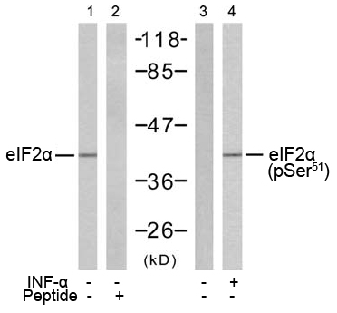 Rabbit Anti-eIF2α (Phospho-Ser51) Polyclonal Antibody WB Rabbit Anti-eIF2α (Phospho-Ser51) Polyclonal Antibody WB