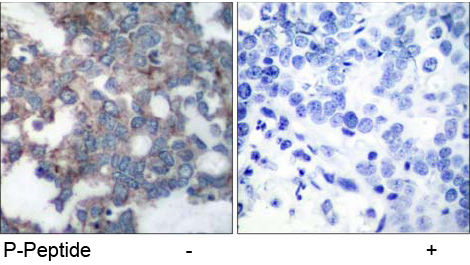 Immunohistochemical analysis using Rabbit Anti p70 S6 Kinase (Phospho-Ser424)