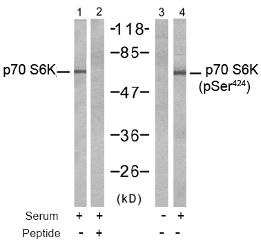Western blot analysis using Rabbit Anti p70 S6 Kinase (Phospho-Ser424)