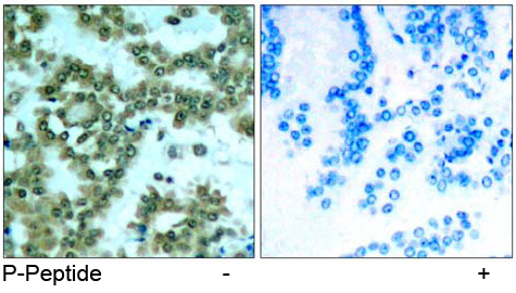 Rabbit Anti-PKCθ (Phospho-Ser676) Polyclonal Antibody IHC Rabbit Anti-PKCθ (Phospho-Ser676) Polyclonal Antibody IHC