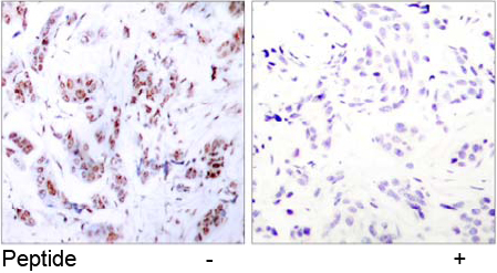 Rabbit Anti-PKR (Phospho-Thr446) Polyclonal Antibody IHC