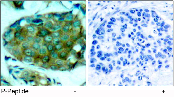 Rabbit Anti mTOR (Phospho-Ser2448) Immunohistochemical analysis using Rabbit Anti mTOR (Phospho-Ser2448)