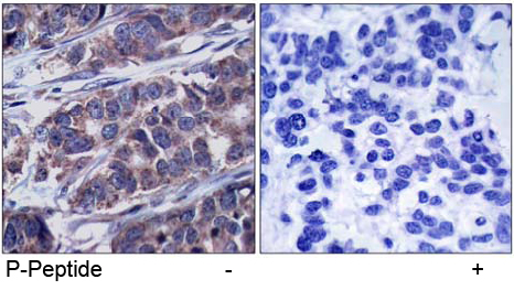 Rabbit Anti-p62Dok (phospho-Tyr362) Polyclonal Antibody IHC Rabbit Anti-p62Dok (phospho-Tyr362) Polyclonal Antibody IHC