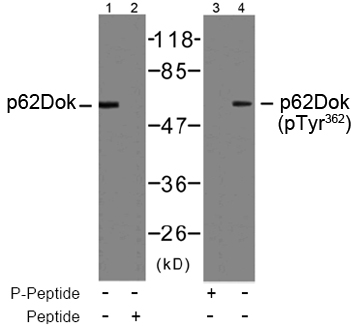 Western blot analysis using Rabbit Anti p62Dok(phospho-Tyr362) Western blot analysis using Rabbit Anti p62Dok(phospho-Tyr362)