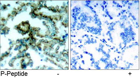 Immunohistochemical analysis using Rabbit Anti PKCβ (Phospho-Thr641)