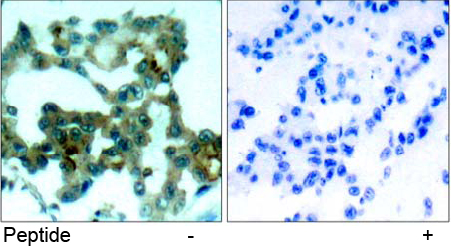 Immunohistochemical analysis using Rabbit Anti PKCβ (Ab-641)