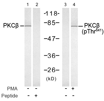 Western blot analysis using Rabbit Anti PKCβ (Ab-641)
