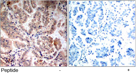 Rabbit Anti-AMPK1 (Ab-174) Polyclonal Antibody IHC Rabbit Anti-AMPK1 (Ab-174) Polyclonal Antibody IHC
