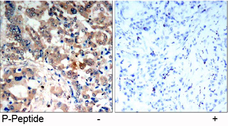 Rabbit Anti Rabbit Anti AMPK1 (Phospho-Thr174) Immunohistochemical analysis using Rabbit Anti AMPK1 (Phospho-Thr174)