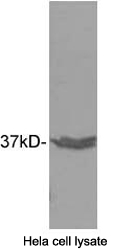 Rabbit Anti Annexin A8 (polyclonal)