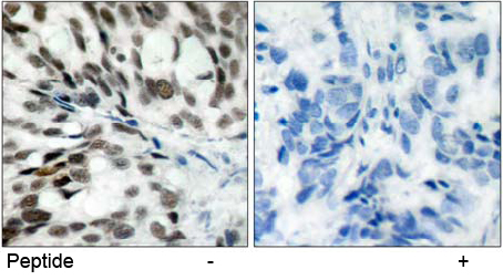 Rabbit Anti Rb (Ab-780) pAb Immunohistochemical analysis Rabbit Anti Rb (Ab-780) pAb Immunohistochemical analysis