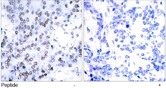 Rabbit Anti JunB (Ab-79) pAb Immunohistochemical analysis Rabbit Anti JunB (Ab-79) pAb Immunohistochemical analysis