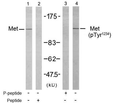 Rabbit Anti-Met (Ab-1234) Polyclonal Antibody Rabbit Anti-Met (Ab-1234) Polyclonal Antibody