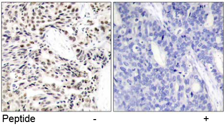 Immunohistochemical analysis using Rabbit Anti NF-κB p65 (Ab-529) pAb