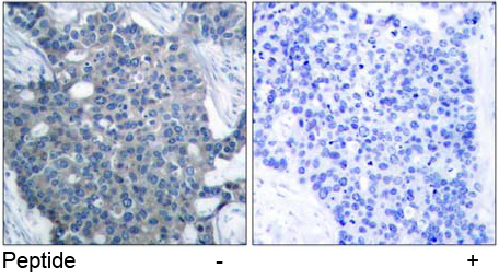 Rabbit Anti-Stathmin 1 (Ab-25) Polyclonal Antibody IHC
