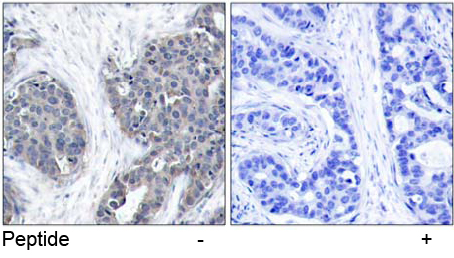 Immunohistochemical analysis using Rabbit Anti Stathmin 1 (Ab-38) pAb