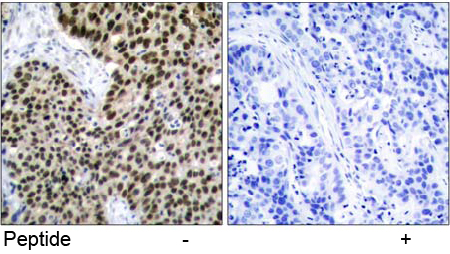 Immunohistochemical analysis using Rabbit Anti HSF1 (Ab-303) pAb