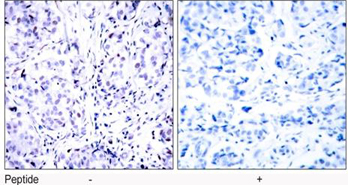 Rabbit Anti Tau  analysis Rabbit Anti Rb (Ab-807) pAb Immunohistochemical analysis