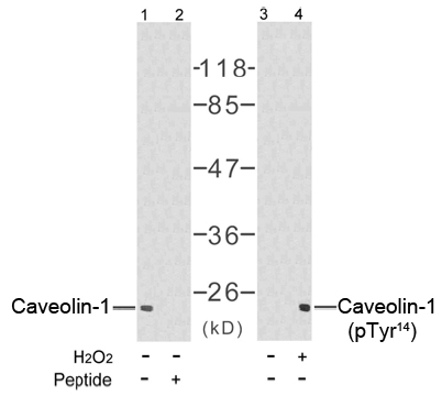 Rabbit Anti-Caveolin-1 (Ab-14) Polyclonal Antibody WB