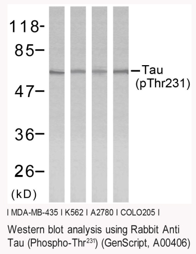 Rabbit Anti Tau (Phospho-Thr231) pAb Western blot analysis